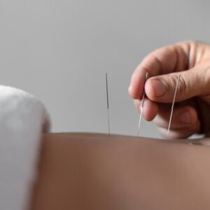 🌸 Comunique a Terapia com Sensibilidade com o Pack de Acupuntura para Fertilidade